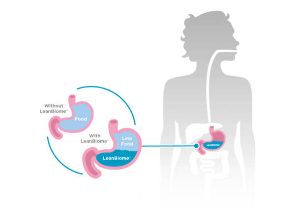 LeanBiome - Image 4